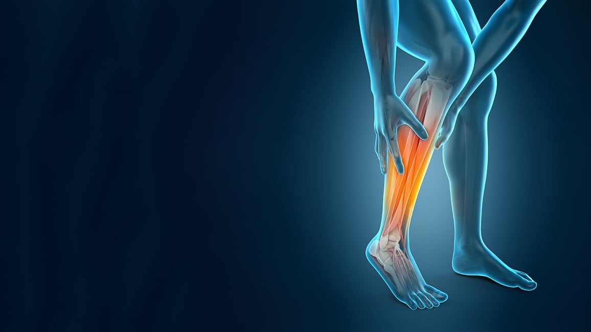 Piriformis Syndrome (T2)-banner-1